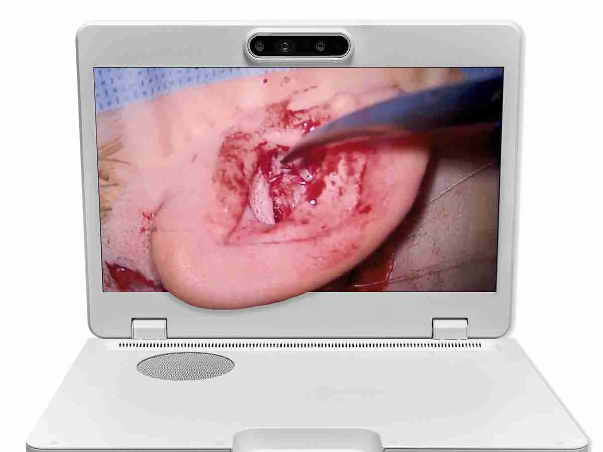 达擎之＂Heads-up 3D显微手术显示系统＂，，，，整合4K裸眼3D显示及眼球追踪系统，，，具备快速追踪人眼移动位置功能，，，，减轻医师长时间维持固定姿势的负担，，，，让医师能有更宽广清晰的3D立体视野及更舒适的姿势来执行手术。。